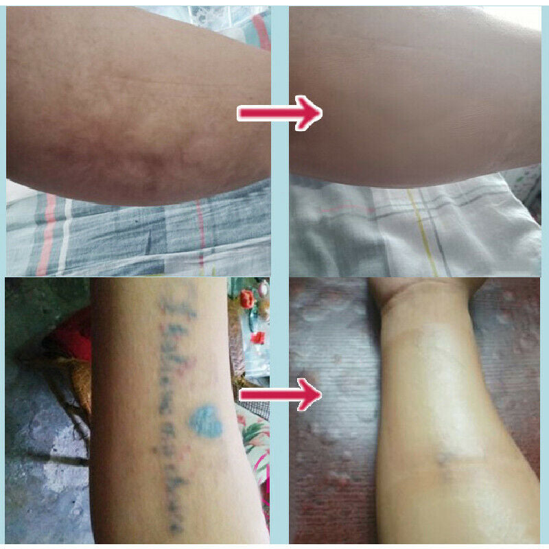 TATTOO CONCEALER TAPE SCAR COVER INVISIBLE STICKER