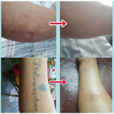 TATTOO CONCEALER TAPE SCAR COVER INVISIBLE STICKER