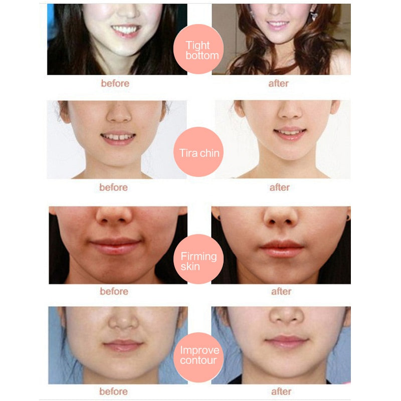 V-SHAPED SLIMMING MASK SET