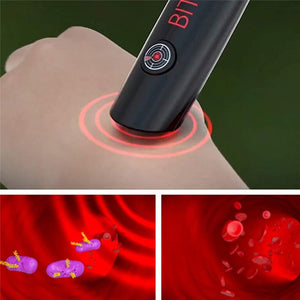 MOSQUITO BITE DETUMESCENCE ANTIPRURITIC PEN