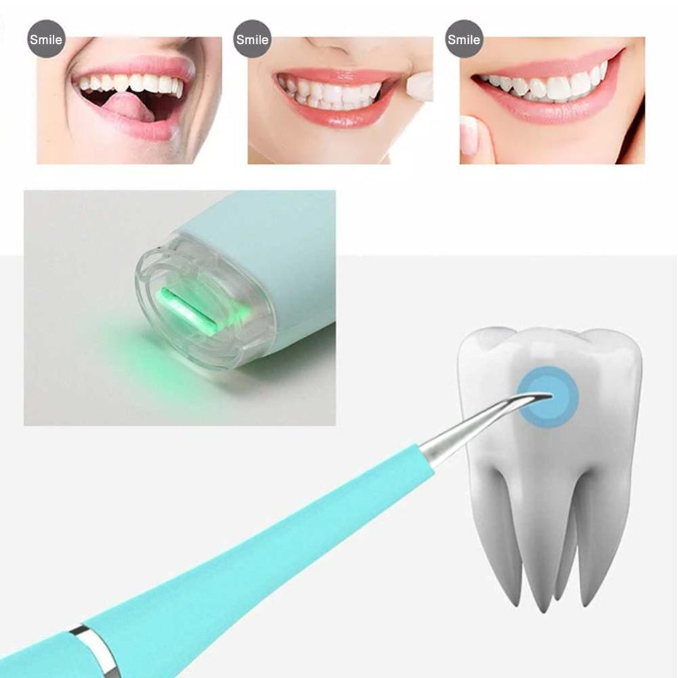 DENTAL CALCULUS PLAQUE REMOVER TOOL KIT